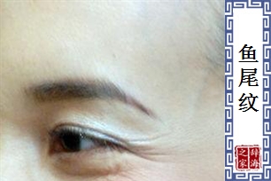 鱼尾纹