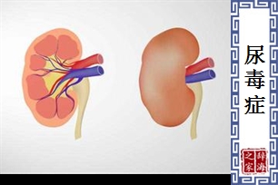 尿毒症