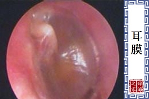 耳膜