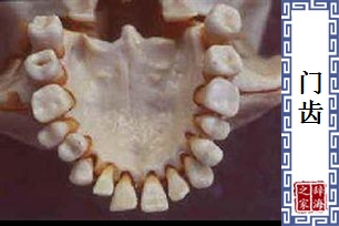 门齿