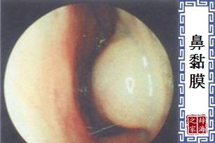 鼻黏膜