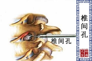 椎间孔